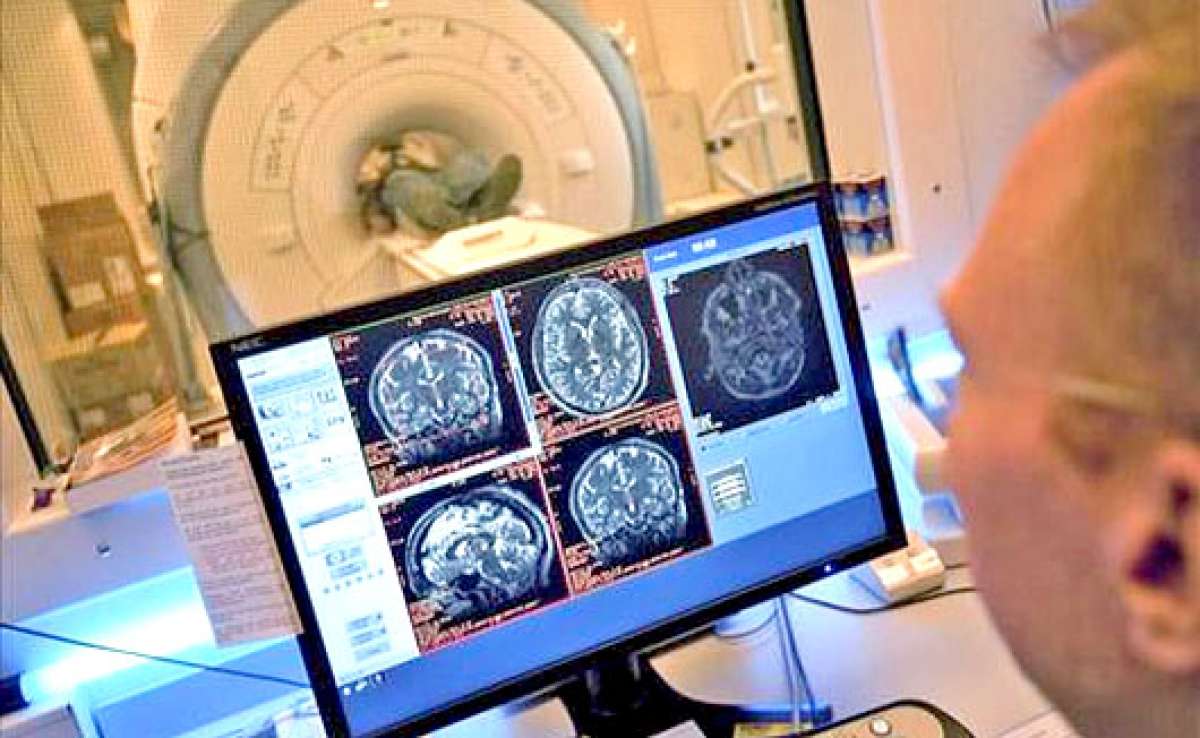 El proyecto cient&iacute;fico intentar&aacute; tratar y eventualmente curar des&oacute;rdenes neurol&oacute;gicos. Foto: EFE
