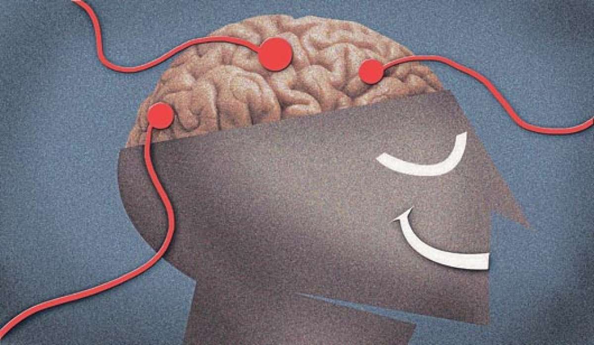 EE.UU. desarrolla implantes para restaurar recuerdos