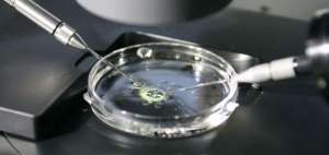 La fecundaci&oacute;n in vitro.