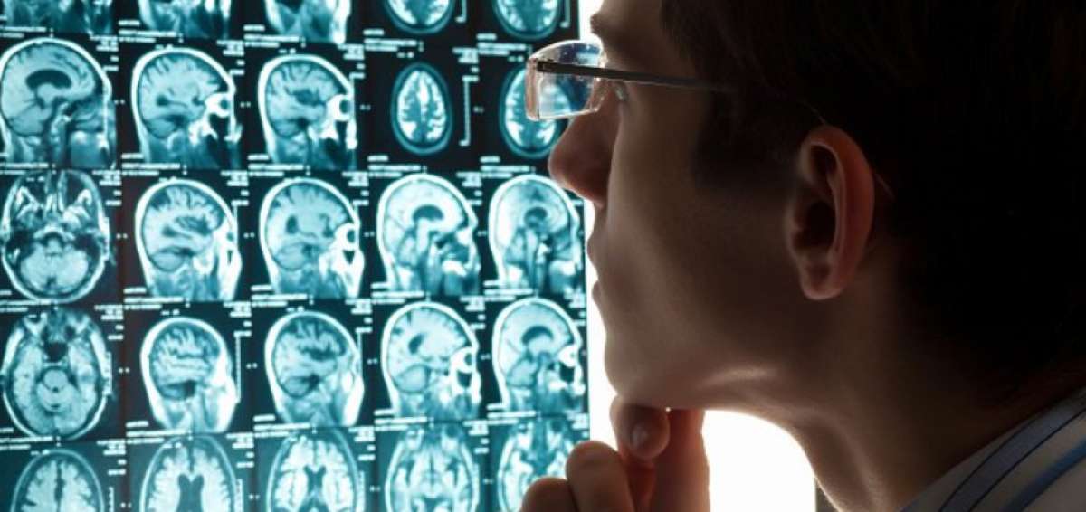 El s&iacute;ndrome por d&eacute;ficit de atenci&oacute;n es un "trastorno cerebral", seg&uacute;n estudio