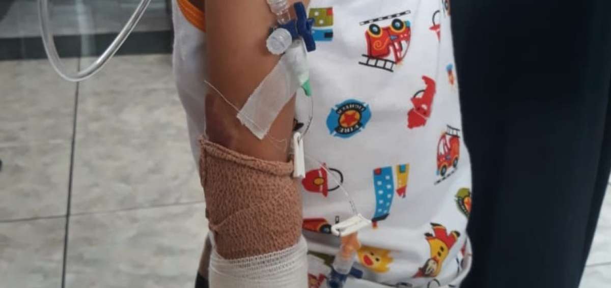 Ricardo sufri&oacute; quemaduras en el 60% de su cuerpo. 