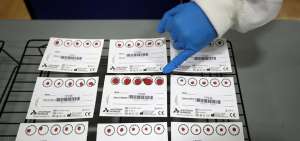 Un ecuatoriano da positivo por coronavirus 15 veces en menos de tres meses en Italia