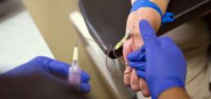 La OMS advierte que 325 millones de personas en el mundo padecen hepatitis