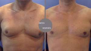 FOTO: http://www.clinicasdiegodeleon.com/ 