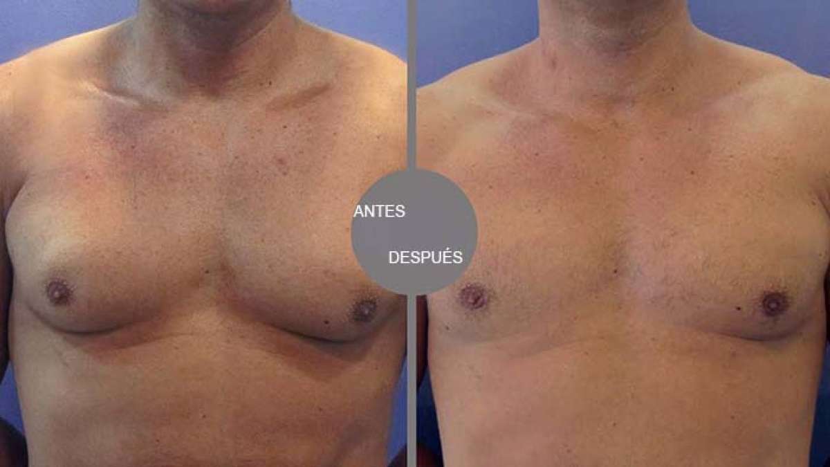 FOTO: http://www.clinicasdiegodeleon.com/ 