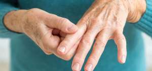 La artritis reumatoide afecta al 1% de personas