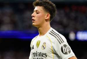 Arda G&uuml;ler pas&oacute; un momento bochornoso