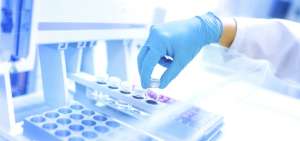 La tuberculosis puede curarse con tratamientos m&aacute;s cortos, seg&uacute;n estudio
