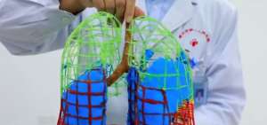 Imprimen modelo en 3D de pulmones de un paciente de COVID-19