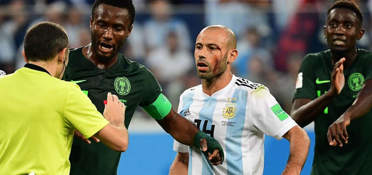 Javier Mascherano tuvo un corte en la cara en los &uacute;ltimos minutos del partido.