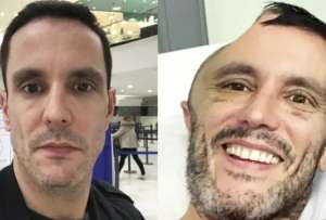 Un descuido en una estaci&oacute;n de metro termin&oacute; en una cirug&iacute;a cerebral de alto riesgo.