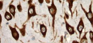 La Porphyromonas gingivalis es una bacteria periodontopat&oacute;gena altamente prevalente en la periodontitis, que  ha sido asociada en estudios epidemiol&oacute;gicos con el desarrollo de alzheimer.