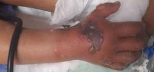 La menor fue brutalmente golpeada. 