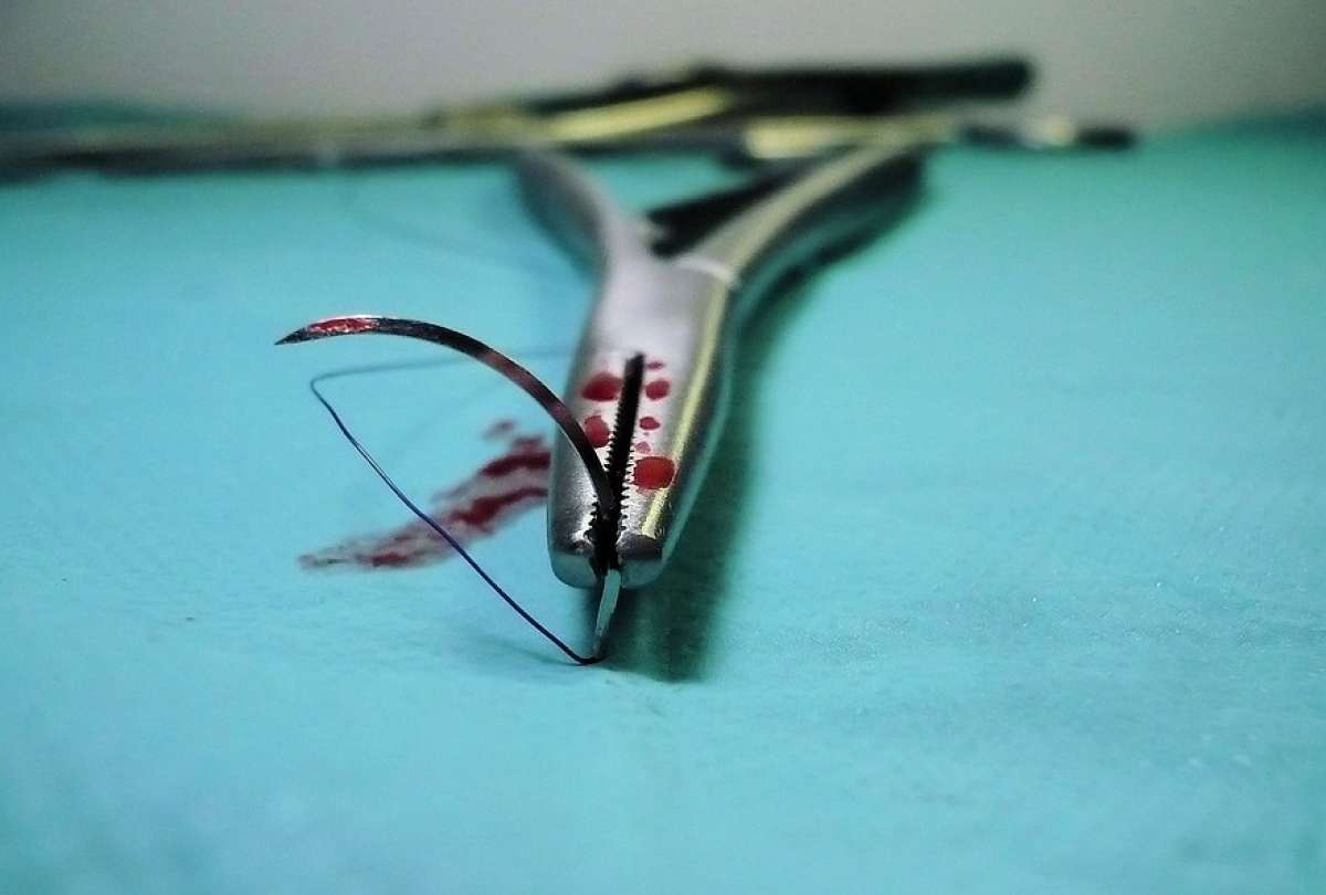 Primera operación de rodilla realizada por un robot en China