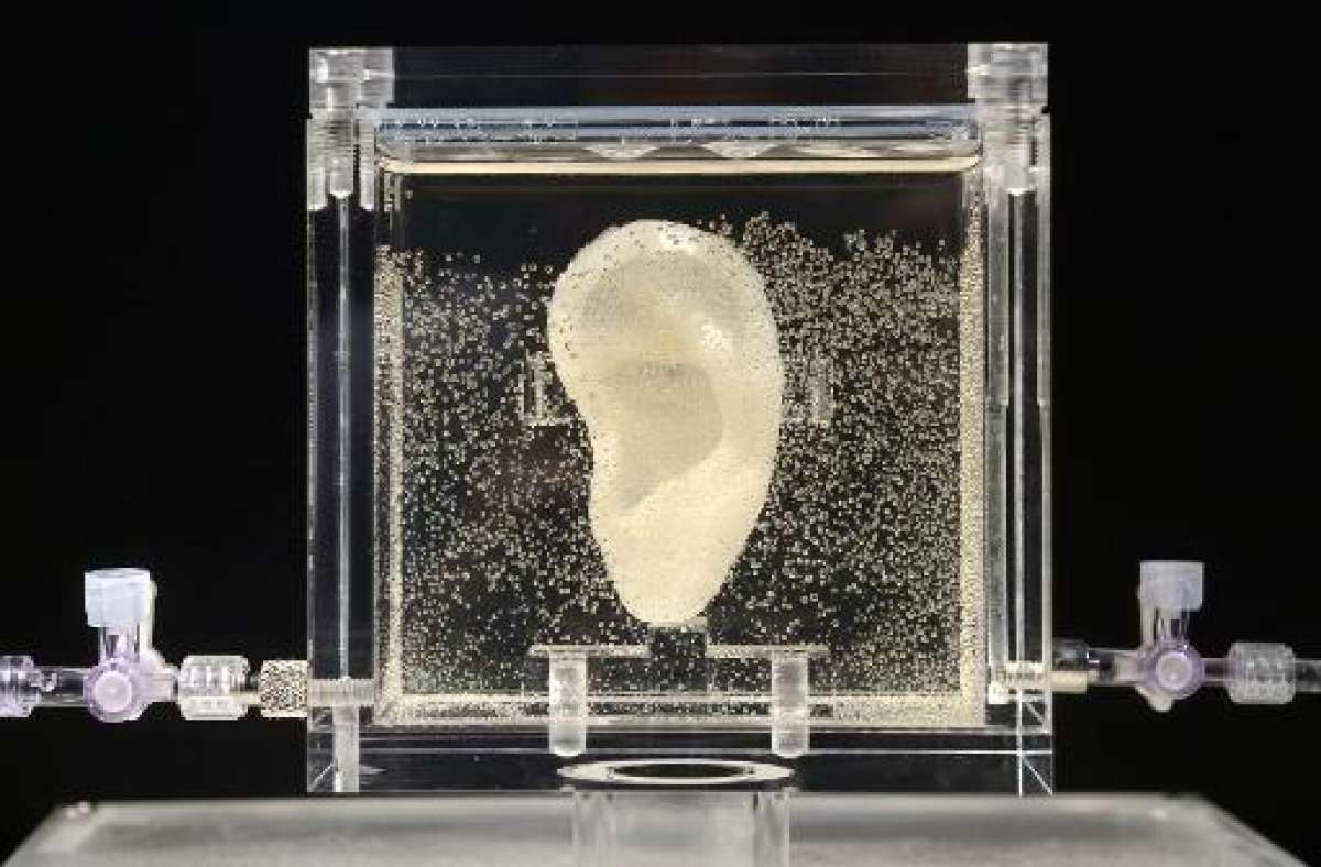 Exponen una r&eacute;plica de la oreja de Van Gogh fabricada con c&eacute;lulas vivas