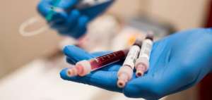Reino Unido empezar&aacute; a probar el test que es capaz de detectar 50 tipos de c&aacute;ncer