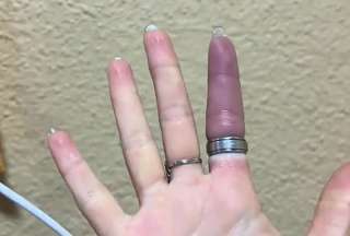 Los bomberos utilizaron herramientas de precisión para cortar el anillo y liberar el dedo de la joven.