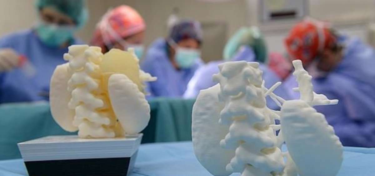 Las copias de pl&aacute;stico servir&aacute;n para analizar las secuelas de la radioterapia contra las malignidades que afectan el ri&ntilde;&oacute;n de los pacientes con c&aacute;ncer. 