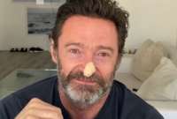 Desde el 2013, el actor Hugh Jackman se ha sometido a seis intervenciones quirúrgicas.