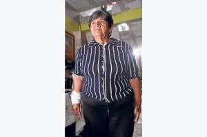 Mar&iacute;a Qui&ntilde;a, de 64 a&ntilde;os, qued&oacute; con la mano derecha lesionada luego de que un metropolitano la transportara con la extremidad atrapada en una ventana. Foto: Karly Torres/El Tel&eacute;grafo