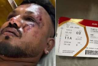 Las impactantes imágenes de Vishwash Kumar Ramesh, único sobreviviente del accidente aéreo en India, se han viralizado en redes sociales y conmocionado al mundo.