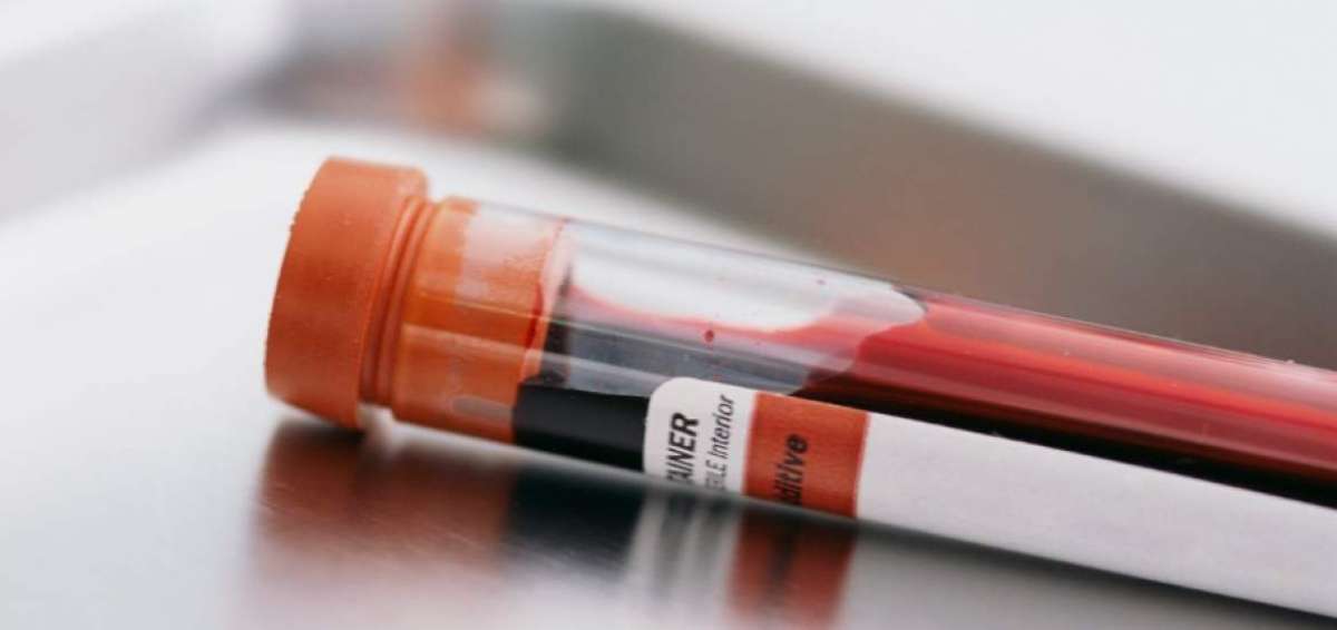 Nuevo examen de sangre podr&iacute;a detectar el c&aacute;ncer
