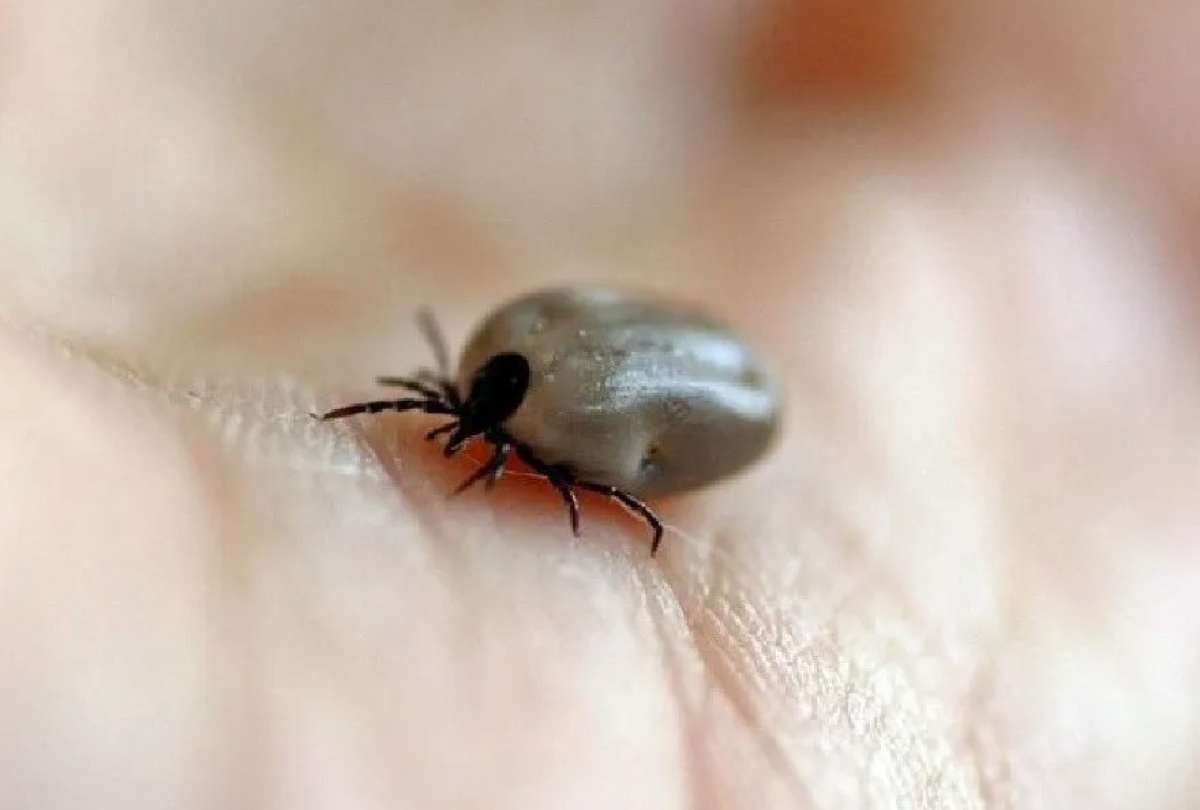 Los principales síntomas de esta alergia rara son urticaria, picor, erupciones cutáneas, dificultad para respirar 