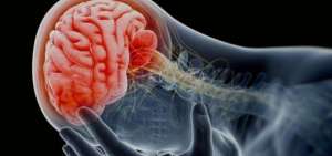 Recuperarse de una conmoci&oacute;n cerebral es m&aacute;s lento de lo que se cre&iacute;a, seg&uacute;n estudio