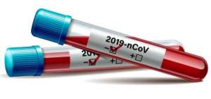 Los cambios que experimentan los virus que son de genoma RNA son menores.