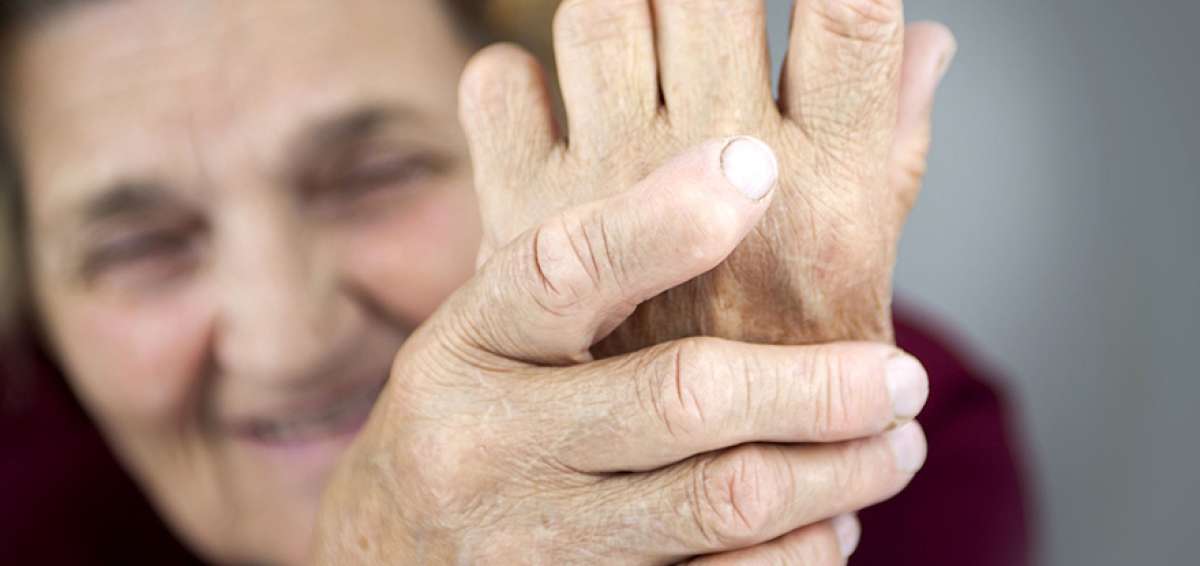Las personas con exceso de peso presentan una mayor frecuencia de osteoartritis. Los hombres con exceso de peso tambi&eacute;n est&aacute;n expuestos a esta enfermedad. 