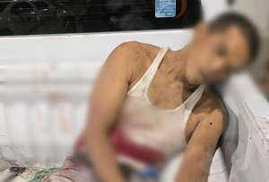 Operativo policial en Guayaquil dejó un presunto antisocial abatido y varias evidencias incautadas en Nueva Prosperina