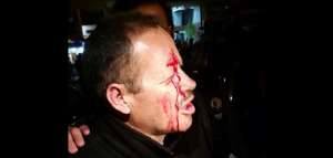 El ciudadano fue agredido con palos por la marcha de la oposici&oacute;n. 