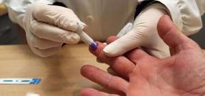 Expertos alertan sobre relaci&oacute;n entre sida, tuberculosis y tabaco en &Aacute;frica