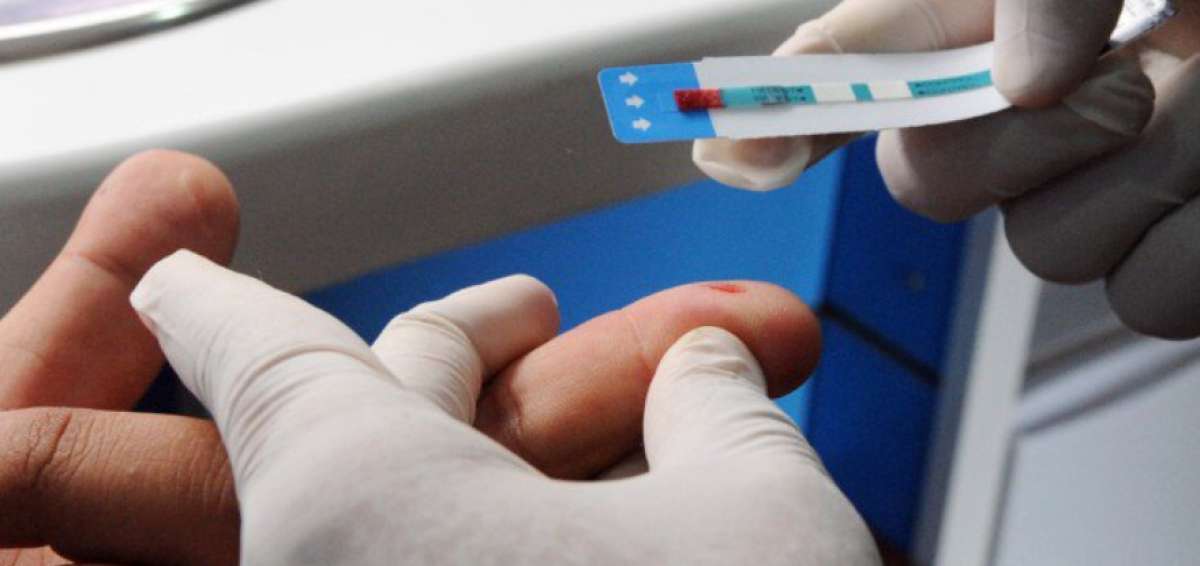 Una vacuna contra el VIH logra resultados estimulantes