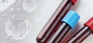 Plasma inmune es una alternativa de tratamiento para el covid-19