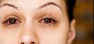 Expertos no descartan que el coronavirus pueda manifestarse en los ojos