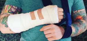 Ed Sheeran es v&iacute;ctima de accidente de bicicleta