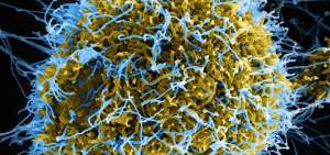 Identifican una v&iacute;a celular implicada en la resistencia al &eacute;bola y a los coronavirus