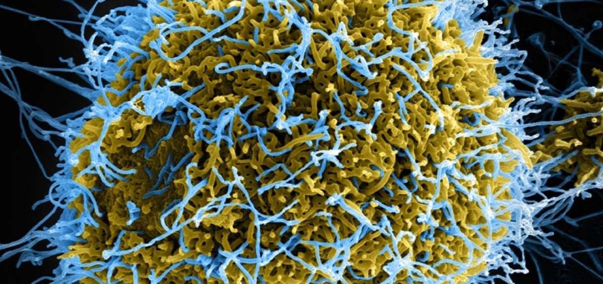 Identifican una v&iacute;a celular implicada en la resistencia al &eacute;bola y a los coronavirus
