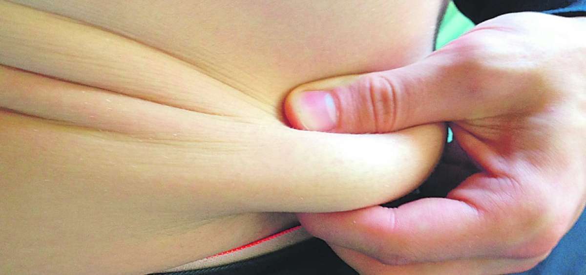La acumulaci&oacute;n de grasa en la zona del abdomen, un riesgo para sufrir diabetes